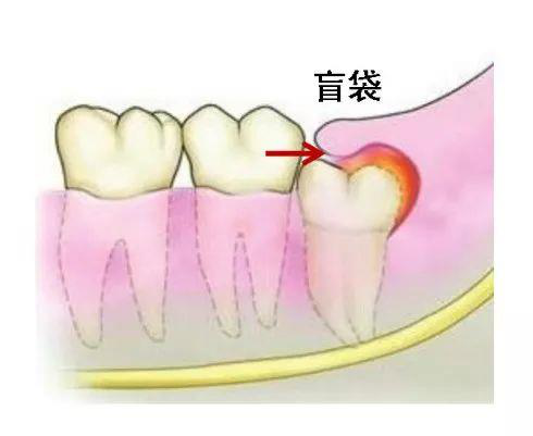1573094425747805UNsn.png 圖片4.png
